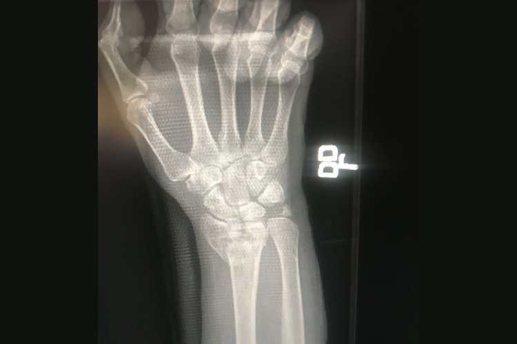 Hand general orthopedics image